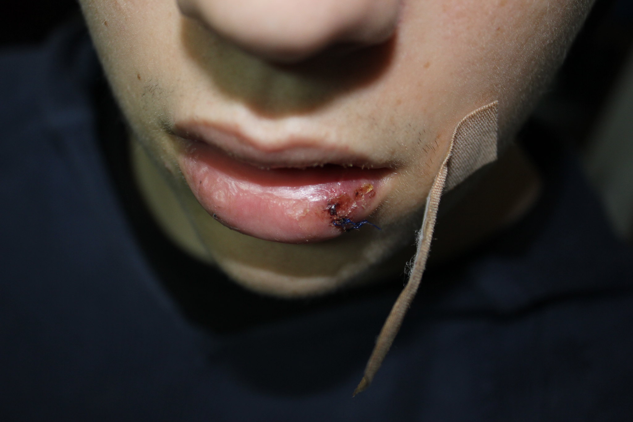 Ein Schüler aus Kolpino wurde von der Polizei wegen des Verdachts des Ladendiebstahls brutal geschlagen