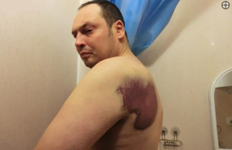 FSB-Mitarbeiter brachten einen Bewohner Kalugas, der wegen seiner Posts in sozialen Netzwerken angeklagt war, in den Wald und schlugen ihn zusammen. Experte: Schläge haben keine gesundheitlichen Schäden verursachten