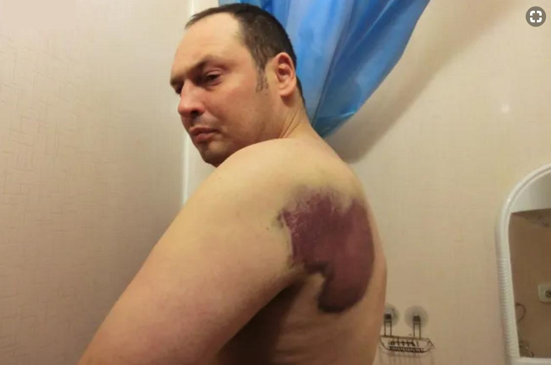 FSB-Mitarbeiter brachten einen Bewohner Kalugas, der wegen seiner Posts in sozialen Netzwerken angeklagt war, in den Wald und schlugen ihn zusammen. Experte: Schläge haben keine gesundheitlichen Schäden verursachten