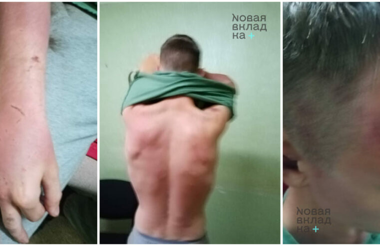 28-летнего калининградца, рассказавшего о пытках, отправили в СИЗО из-за поджога инсталляции с буквой Z