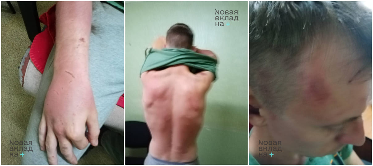 28-летнего калининградца, рассказавшего о пытках, отправили в СИЗО из-за поджога инсталляции с буквой Z